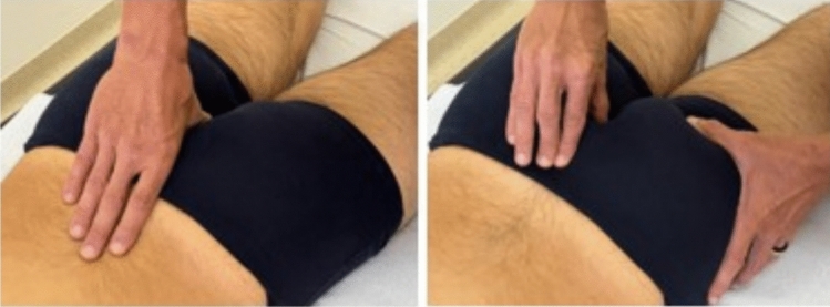 The presence of abnormal palpatory findings in the sacrococcygeal area is correlated with chronic pelvic pain: a cross-sectional study.