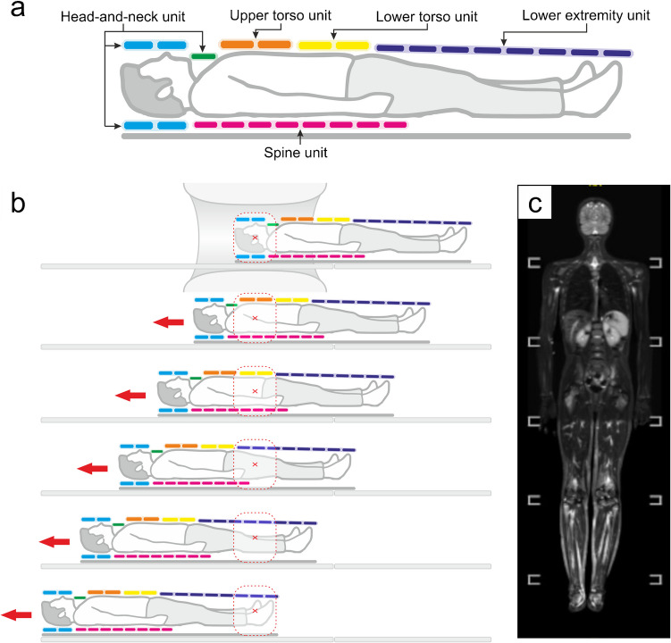 Whole-body MRI in arthritis.