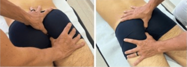 The presence of abnormal palpatory findings in the sacrococcygeal area is correlated with chronic pelvic pain: a cross-sectional study.
