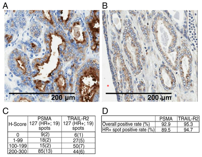 Novel tetravalent bispecific antibody, PSMA/TRAIL‑R2 REGULGENT™, induces selective tumor cell apoptosis without hepatotoxicity.