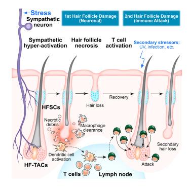 Hyperactivation Stress-induced sympathetic hyperactivation drives hair follicle ...