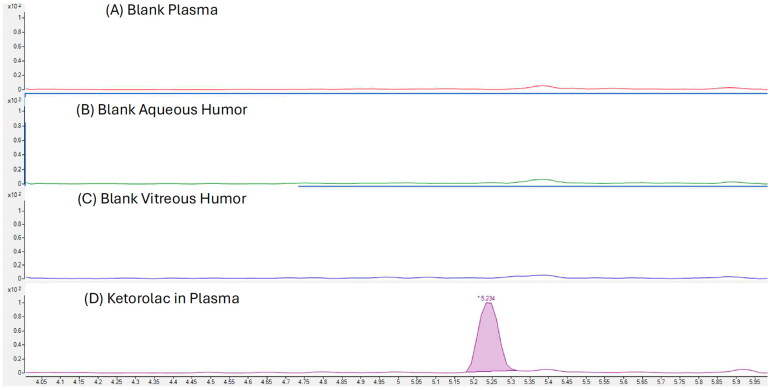 Bioanalytical method validation to quantify ketorolac in human vitreous and aqueous via surrogate matrix of human plasma.