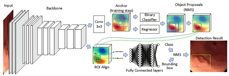 Artificial intelligence-assisted diagnosis of early gastric cancer: present practice and future prospects.