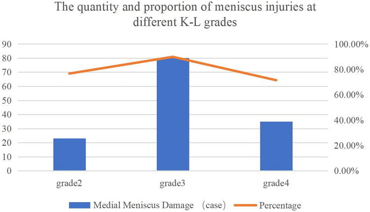 Association between knee osteoarthritis and foot deformities: epidemiological analysis of hallux valgus and flatfoot.