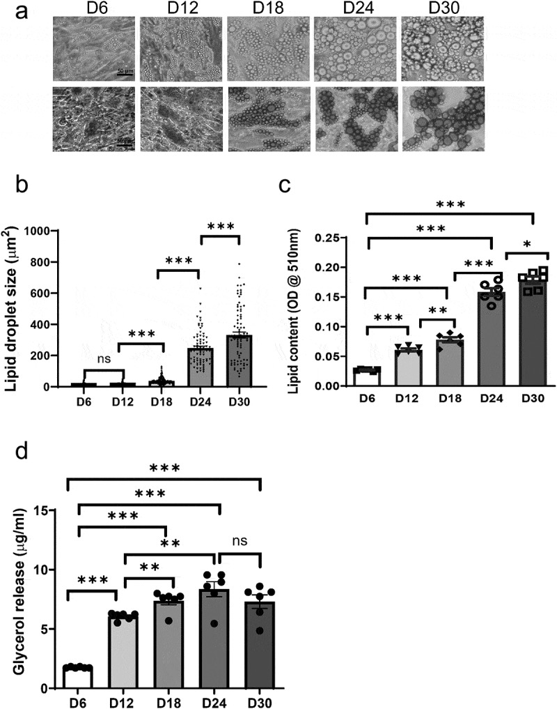 Disrupted adipokine secretion and inflammatory responses in human adipocyte hypertrophy.