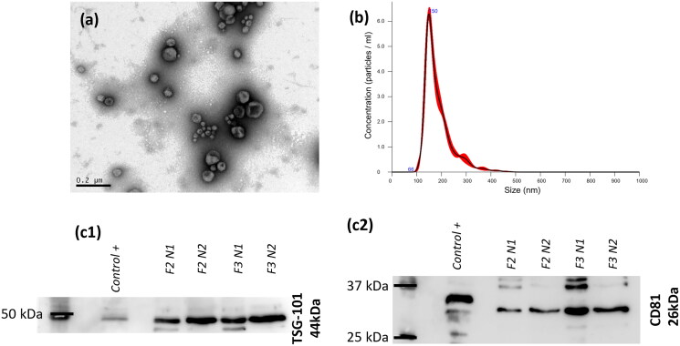 Hyaluronic acid-engineered milk extracellular vesicles to target triple negative breast cancer through CD44.