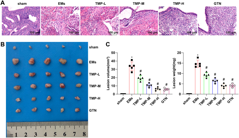 Tetramethylpyrazine Confers Protection Against Oxidative Stress and NLRP3-Dependent Pyroptosis in Rats with Endometriosis.