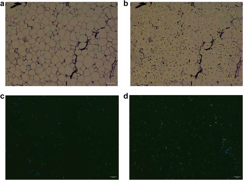 Perivascular adipocyte size is related to the lipid profile and inflammatory changes in a healthy population.