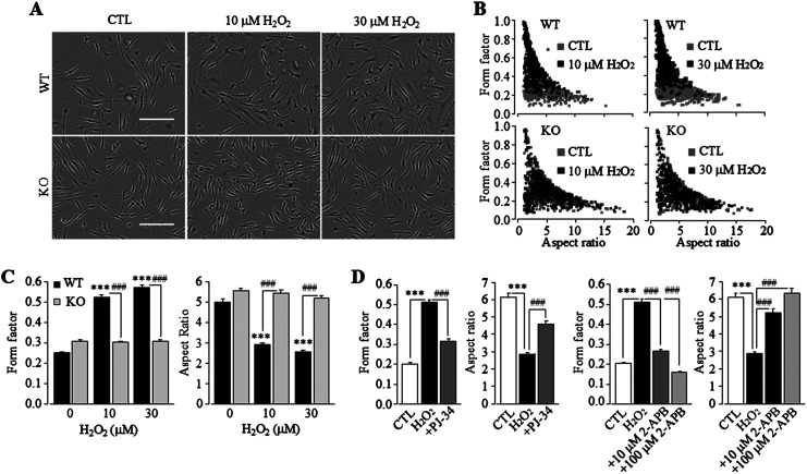 The PKC/NOX/ROS and PYK2/MEK/ERK/PARP signalling pathways drive TRPM2 channel activation induced by non-cytolytic oxidative stress in microglial cells.