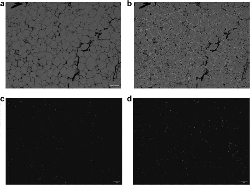Perivascular adipocyte size is related to the lipid profile and inflammatory changes in a healthy population.