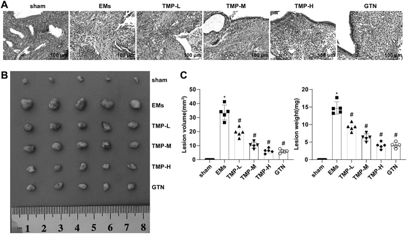 Tetramethylpyrazine Confers Protection Against Oxidative Stress and NLRP3-Dependent Pyroptosis in Rats with Endometriosis.