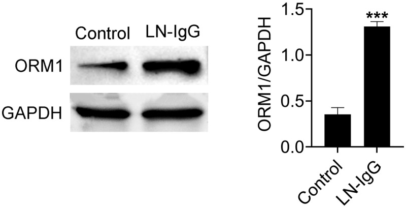 ORM1 Mediates Ln-IgG-Induced Podocyte Damage and Autophagy via the AMPK/mTOR Signaling.