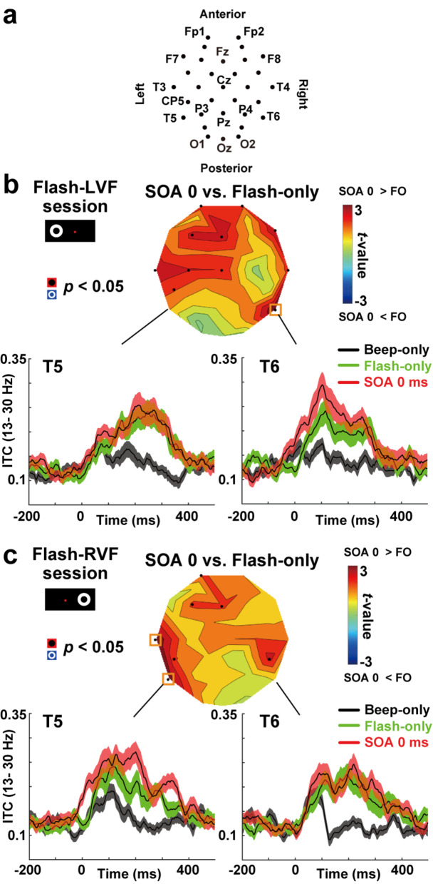 The role of beta band phase resetting in audio-visual temporal order judgment.