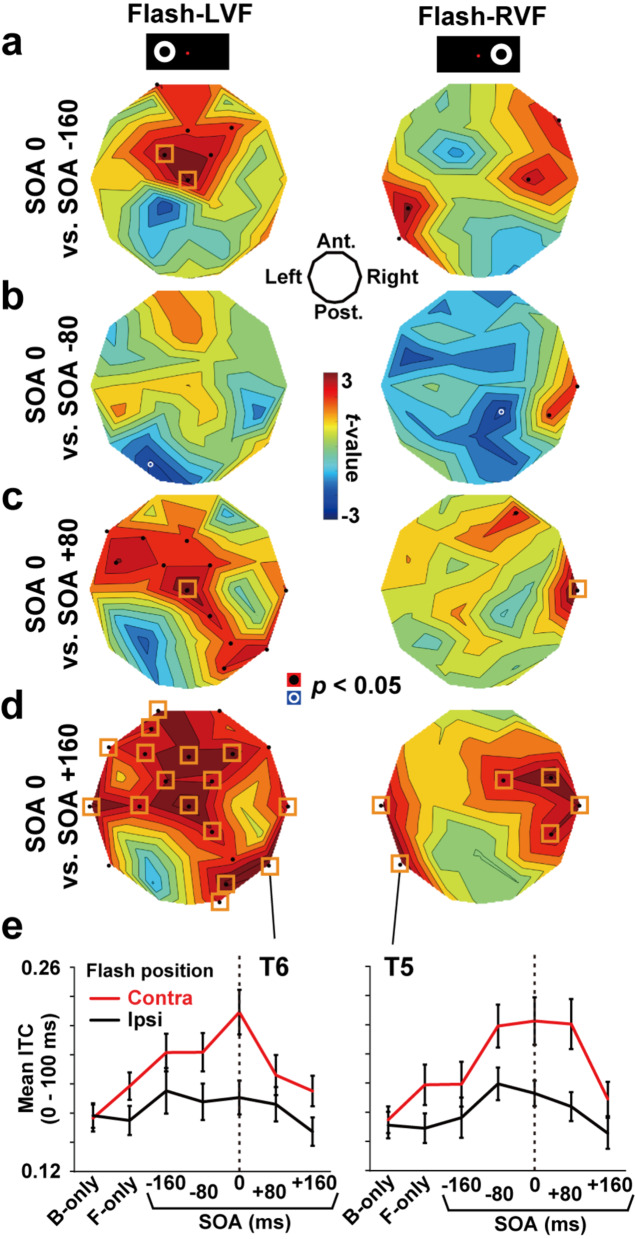 The role of beta band phase resetting in audio-visual temporal order judgment.