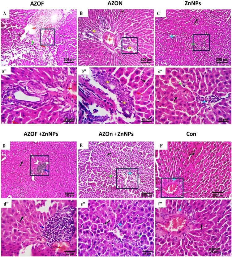 Zinc nanoparticles mitigate azoxystrobin and its nanoencapsulation-induced hepatic and renal toxicity in rats.