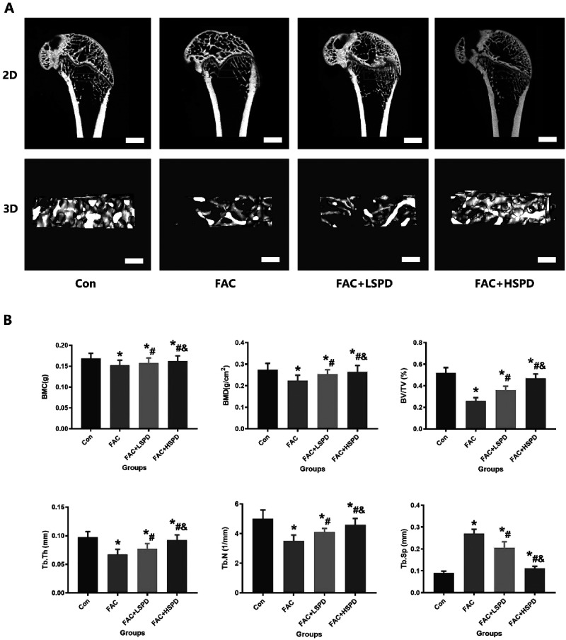 Spermidine prevents iron overload-induced impaired bone mass by activating SIRT1/SOD2 signaling in senile rat model.