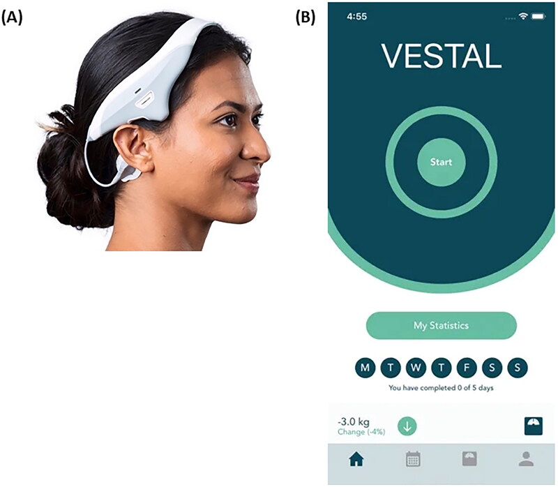 Efficacy of electrical vestibular stimulation (VeNS) on adults with insomnia: A double-blind, randomized, sham-controlled trial.