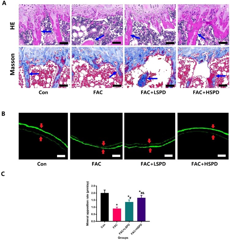 Spermidine prevents iron overload-induced impaired bone mass by activating SIRT1/SOD2 signaling in senile rat model.