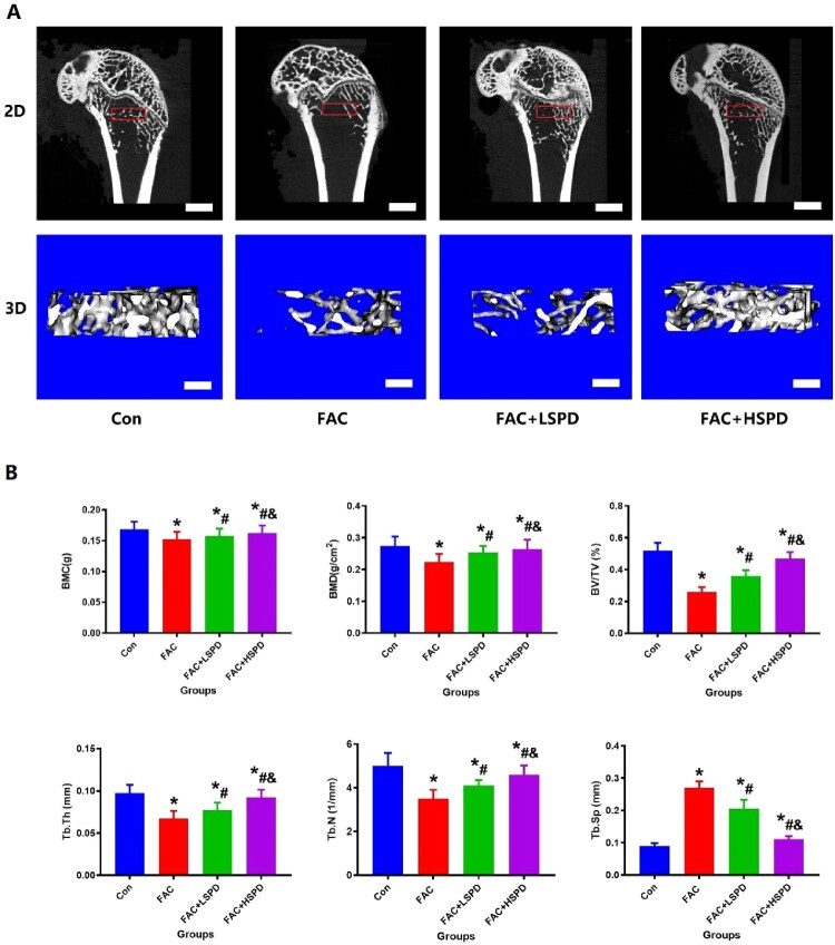 Spermidine prevents iron overload-induced impaired bone mass by activating SIRT1/SOD2 signaling in senile rat model.