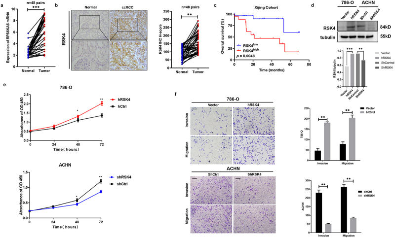 RSK4 promotes the metastasis of clear cell renal cell carcinoma by activating RUNX1-mediated angiogenesis.