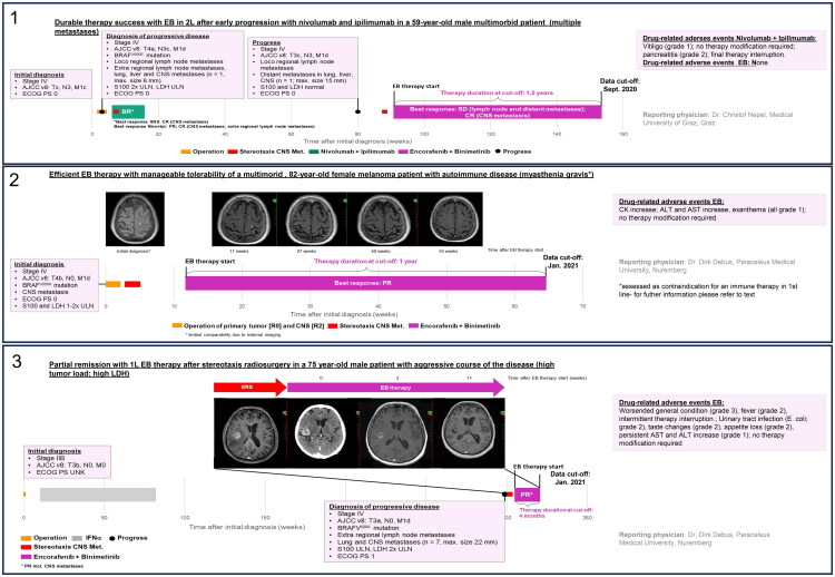 Personalized therapies in advanced BRAFV600-mutated melanoma: review based on 3 case reports of the REMINISCENCE project.