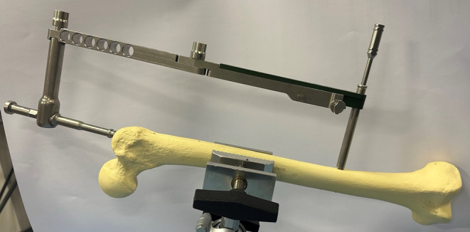 Frugal Innovations in Orthopaedics.