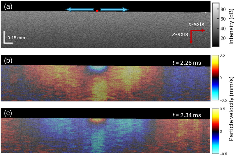 Quantifying age and spatial variations of bone marrow elasticity with noncontact optical coherence elastography.