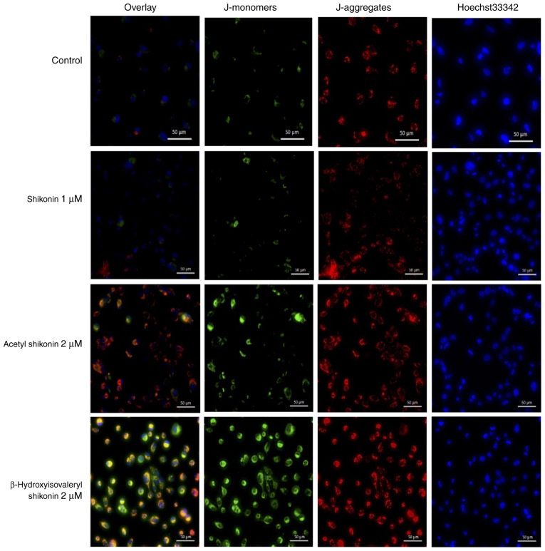 Induction of immunogenic necroptosis by shikonin in drug‑resistant head and neck squamous cell carcinoma cells.