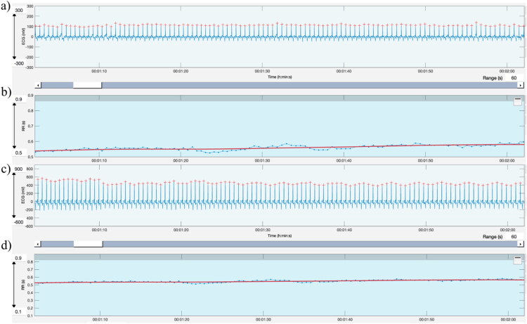Validation of a new textile sensor band for on-farm heart rate variability assessment in calves.