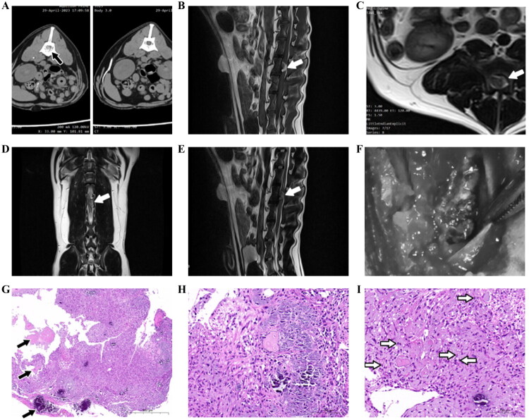 <i>In vitro</i> characterization of OSA-424 and OSA-55: new canine models for osteosarcoma research.