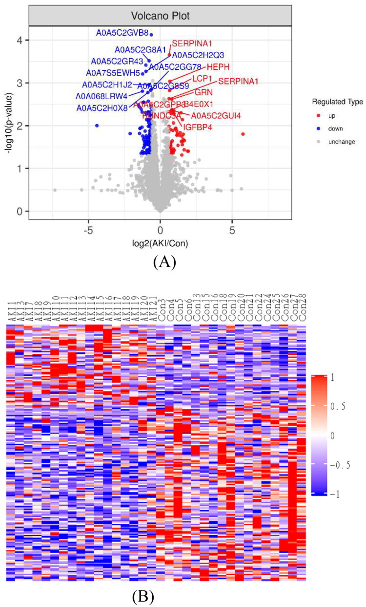 Integrated lipidomics and proteomics analysis in the cardiac surgery-associated acute kidney injury.