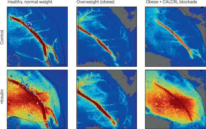 Obesity induces systemic insulin resistance via endothelium-specific insulin receptor inhibition