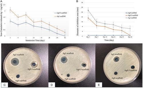 Functional Silver-Loaded Porous Composite Scaffold for Bone Tissue Bacterial Infection