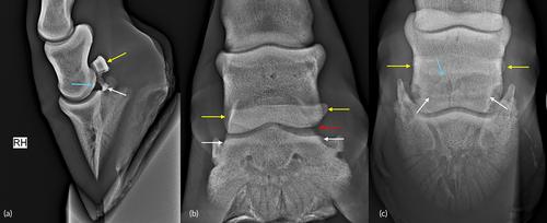 Transverse navicular bone fracture in a hindlimb of a young Warmblood mare