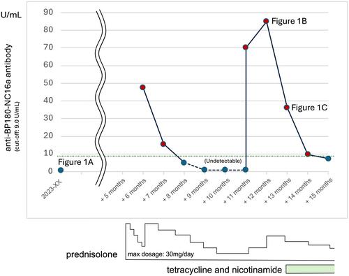 Home-based collaborative management of bullous pemphigoid with delayed seropositive conversion of anti-BP180-NC16a antibody