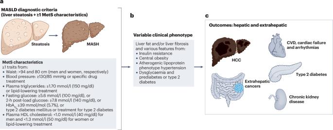 Μetabolic dysfunction-associated steatotic liver disease: a condition of heterogeneous metabolic risk factors, mechanisms and comorbidities requiring holistic treatment