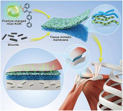 Tissue Mimetic Membranes for Healing Augmentation of Tendon–Bone Interface in Rotator Cuff Repair