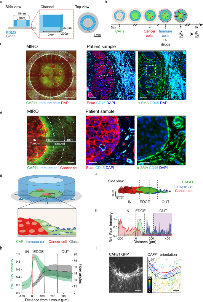 Micro Immune Response On-chip (MIRO) models the tumour-stroma interface for immunotherapy testing