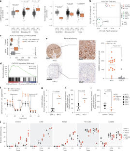 Oncogenic TFE3 fusions drive OXPHOS and confer metabolic vulnerabilities in translocation renal cell carcinoma