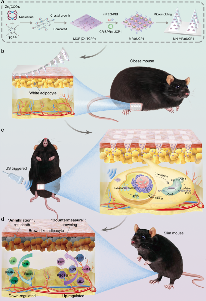 Transdermal microneedle-assisted ultrasound-enhanced CRISPRa system to enable sono-gene therapy for obesity