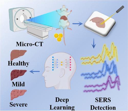 Identification of SERS Fingerprints for Diagnosis and Staging of Liver Injury