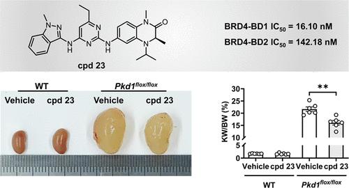 Design of Selective BRD4 Inhibitors for the Treatment of Autosomal Dominant Polycystic Kidney Disease