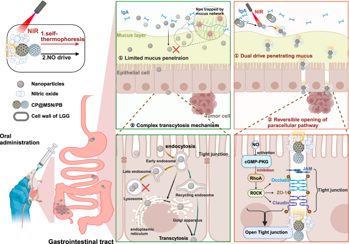 Bioactive nanomotor enabling efficient intestinal barrier penetration for colorectal cancer therapy