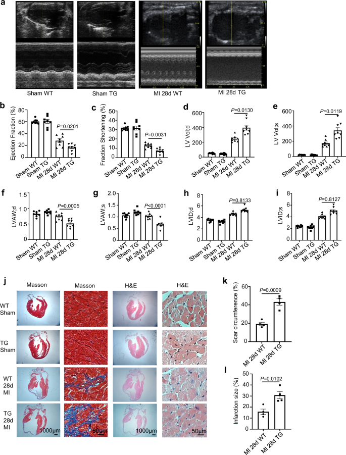 S100A12 triggers NETosis to aggravate myocardial infarction injury via the Annexin A5-calcium axis