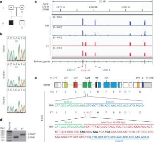 STIM1-mediated NFAT signaling synergizes with STAT1 to control T-bet expression and TH1 differentiation