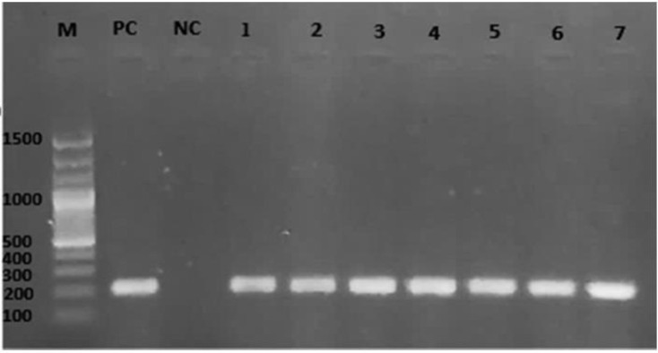 <i>Escherichia coli</i> in septic arthritis: prevalence and antibiotics susceptibility patterns.