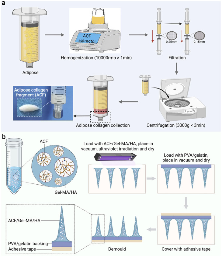Dissolving microneedle patch loaded with adipokines-enriched adipose extract relieves atopic dermatitis in mouse via modulating immune disorders, microbiota imbalance, and skin barrier defects.