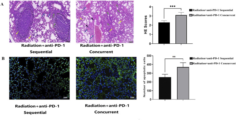 Comparative Analysis of Concurrent vs Sequential Administration of anti-PD-1 Following Thoracic Radiotherapy: Impact on Lung Tissue Damage.