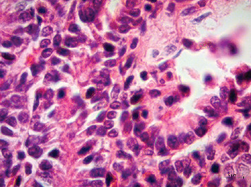 Infection by Adenovirus Type 2 in a Short-Tailed Bat in Mexico.