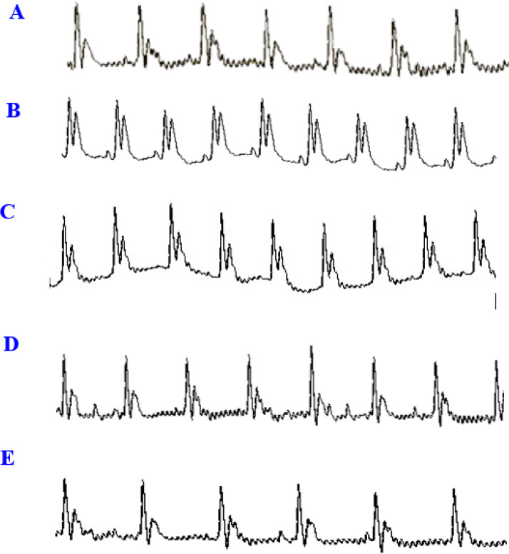 Cardioprotective potential of protocatechuic acid against doxorubicin-induced cardiotoxicity in rats.